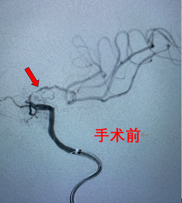 https://hongxinghao-qiniu-static.cdsb.com/official_account/image/202211/54/d62b85c1e5e2ed41417e0361177952ca224977.png-cdsb.onlycompress